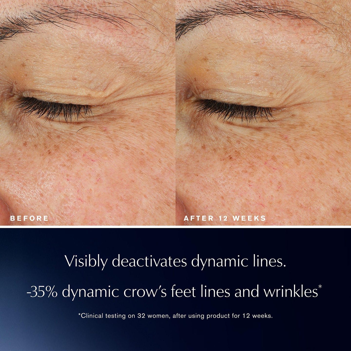 Крем для глаз Advanced Night Repair Eye Lift + Sculpt — фото 2
