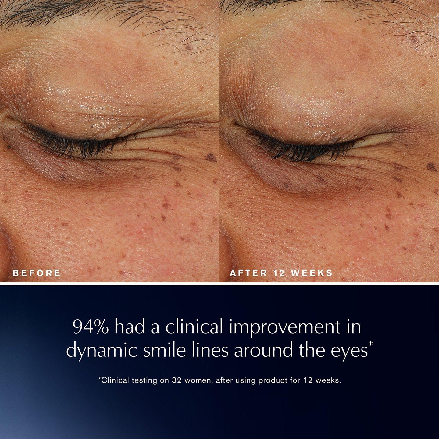 Крем для глаз Advanced Night Repair Eye Lift + Sculpt — фото 3
