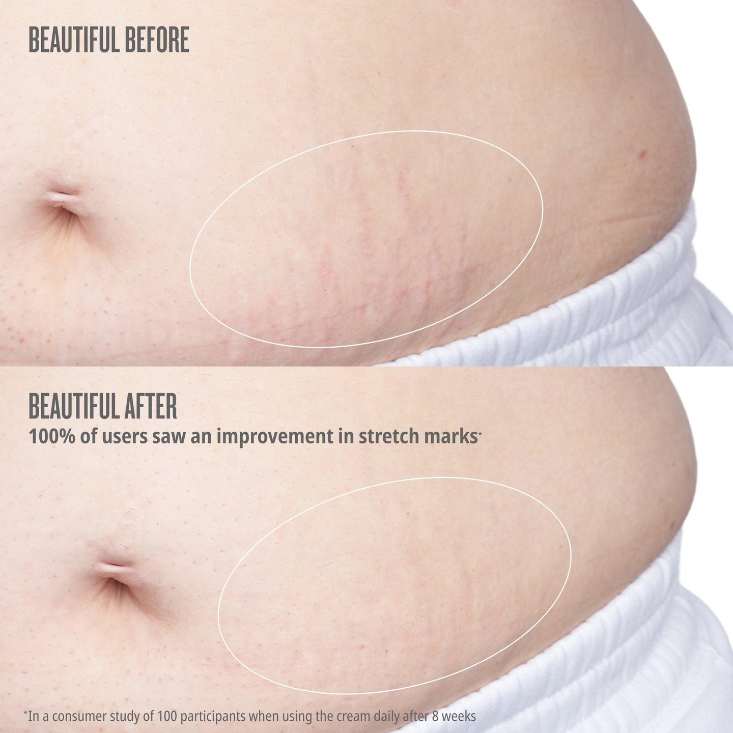 Масло для тела Elasti-Body от Beija Flor — фото 4