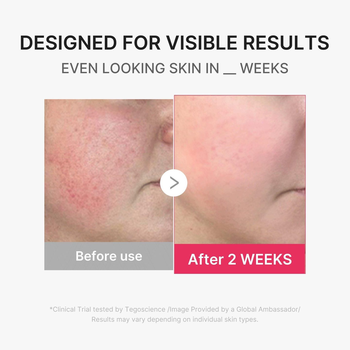 Booster Pro Mini Plus — фото 5