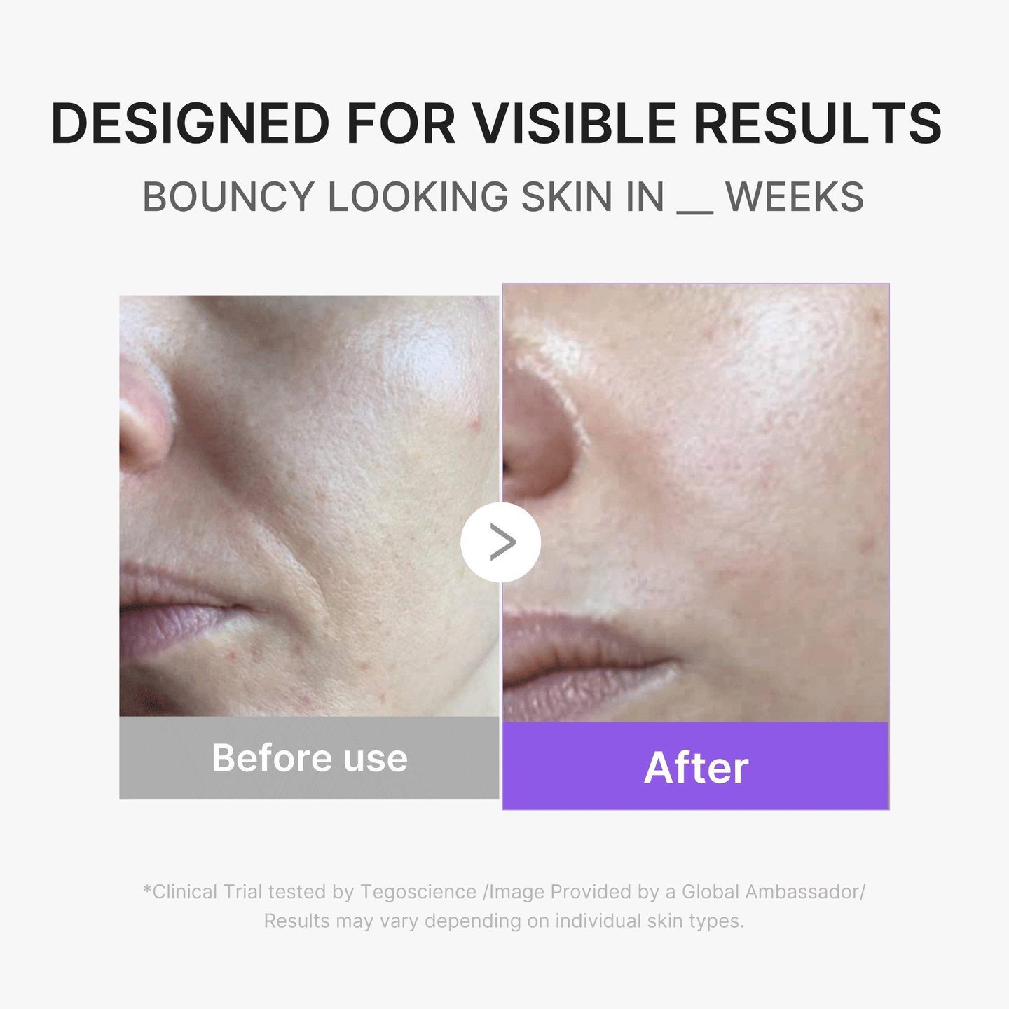 Booster Pro Mini Plus — фото 4