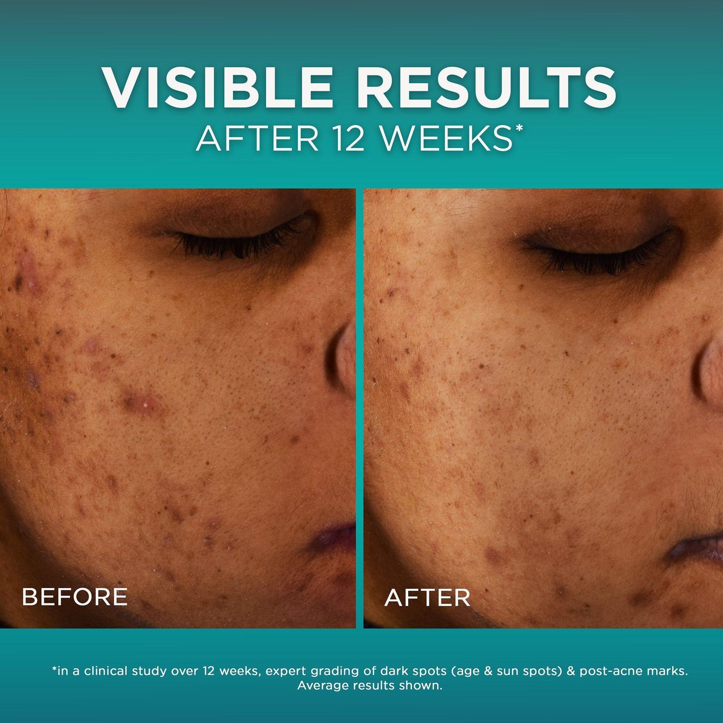Сыворотка для лица Bright Reveal с 12% ниацинамидом — фото 3