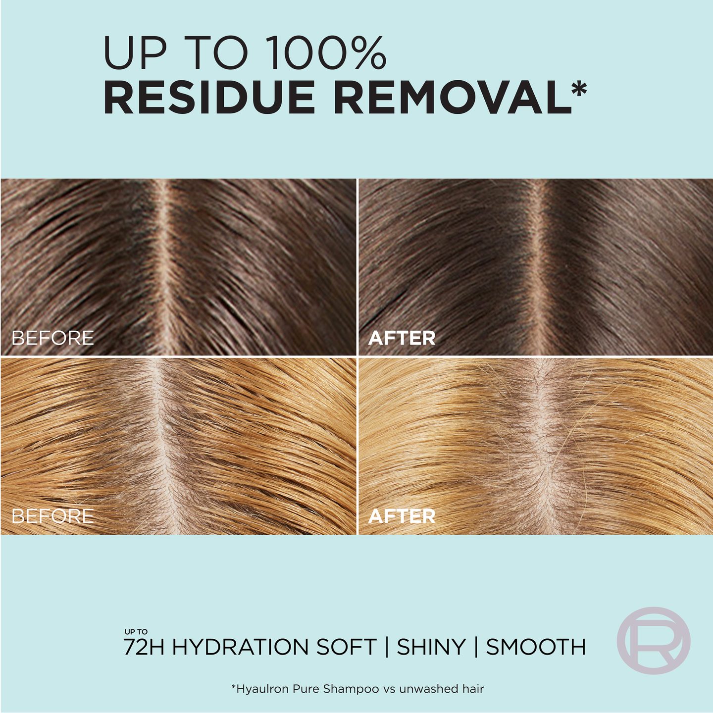 Сыворотка Elvive Hyaluron Pure Oil Erasing для жирных волос — фото 3