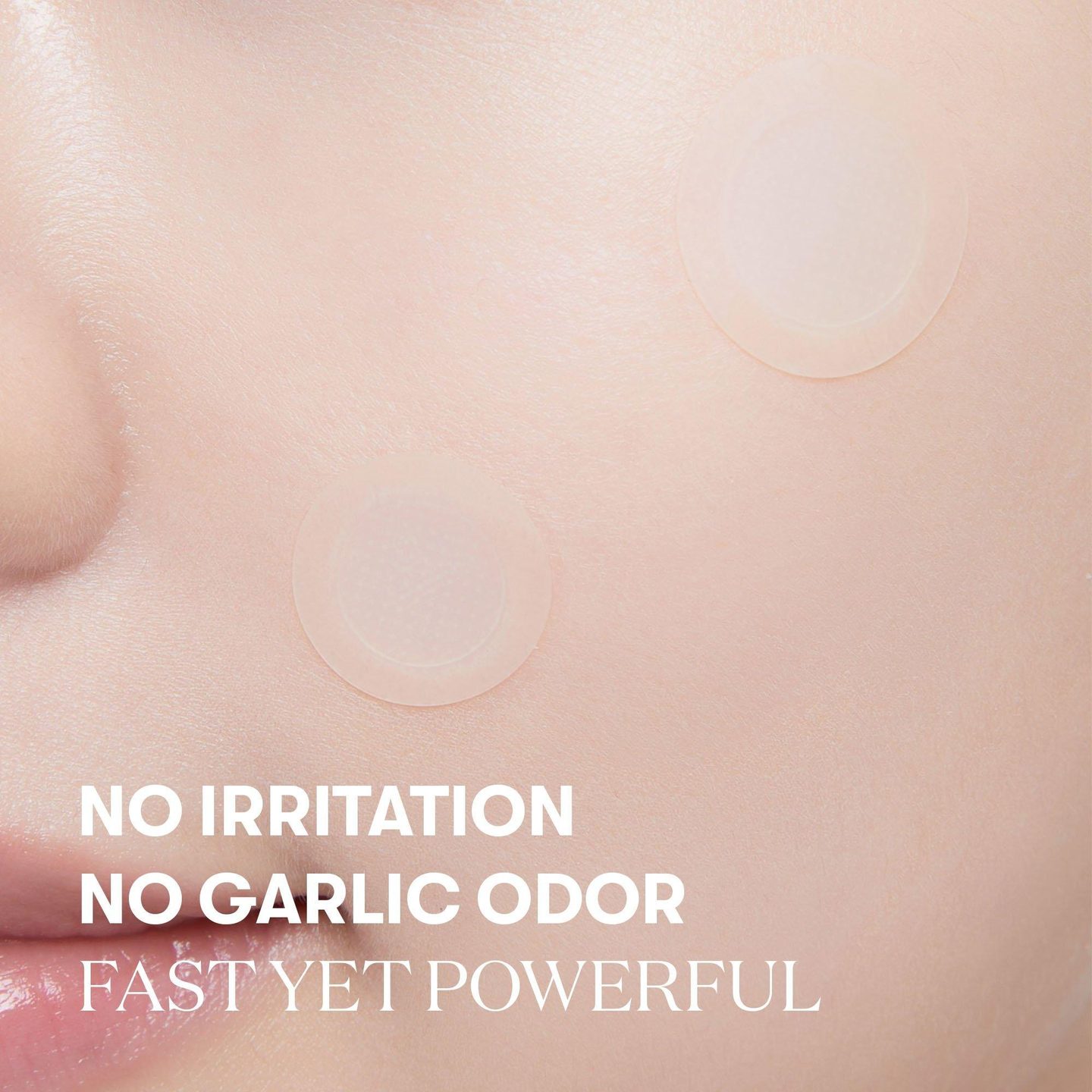 Патч для точечного ухода Garlic AC Reedle Shot — фото 4