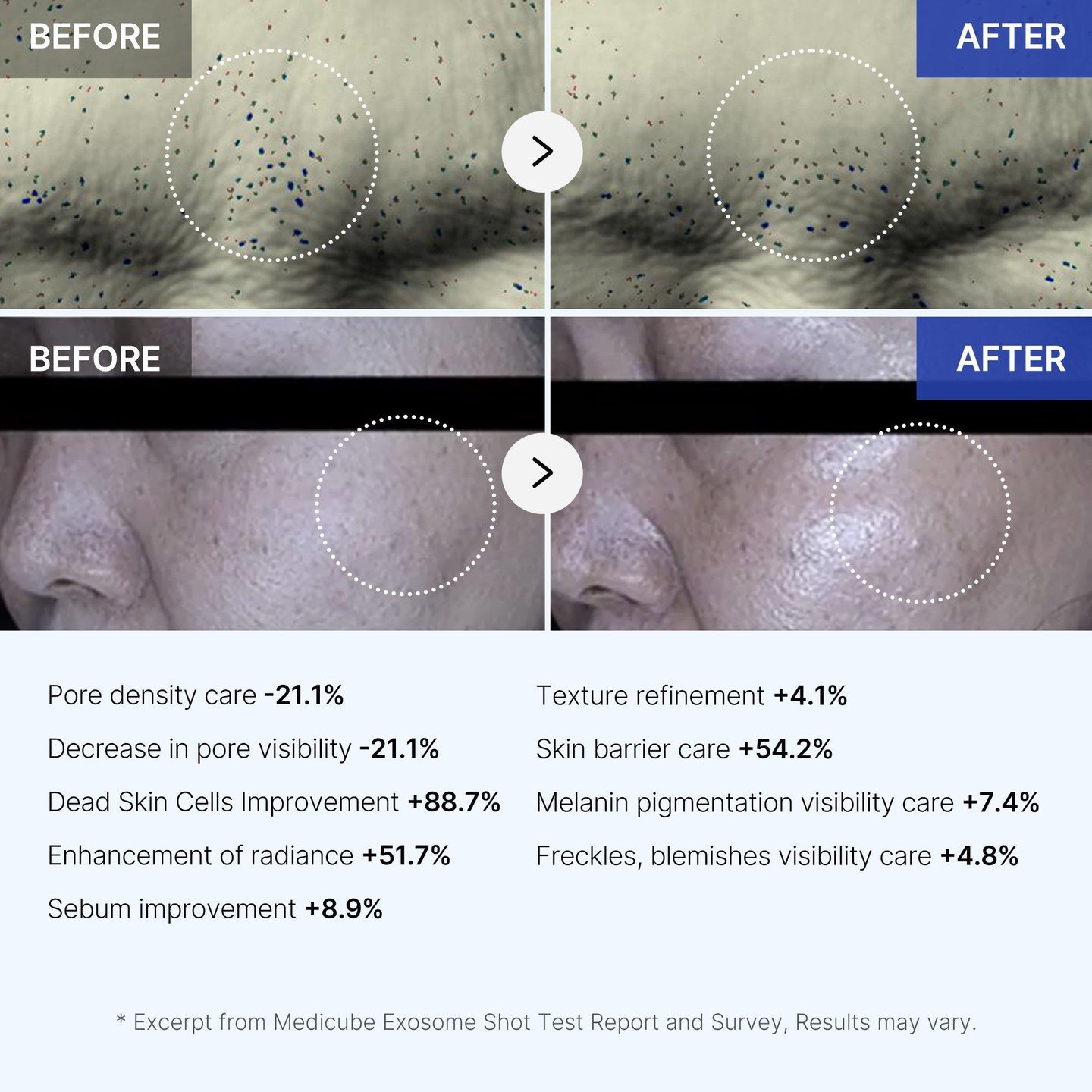 Однодневный экзосомный шот 2000 — фото 7