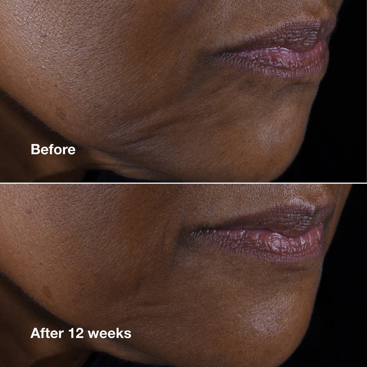 Крем для лица и шеи Smart Clinical Repair Lifting — фото 5