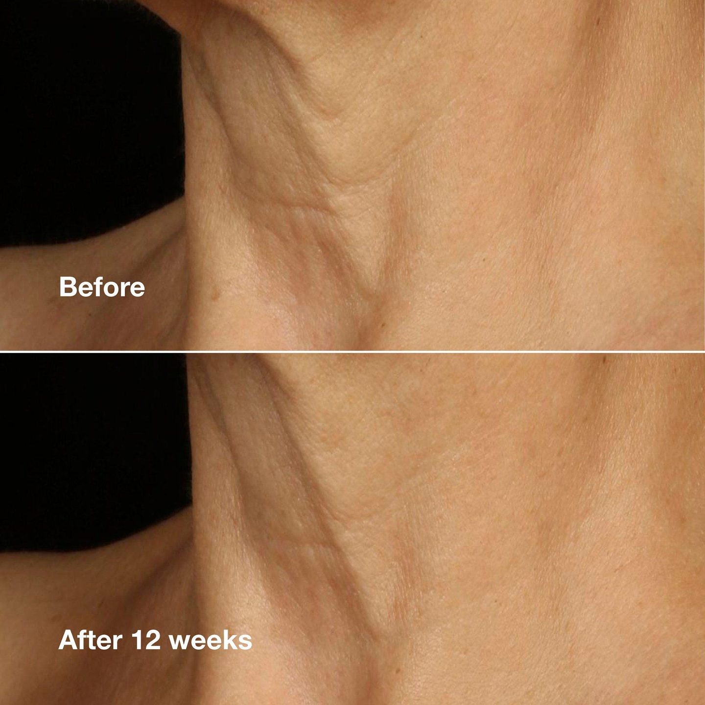 Крем для лица и шеи Smart Clinical Repair Lifting — фото 4