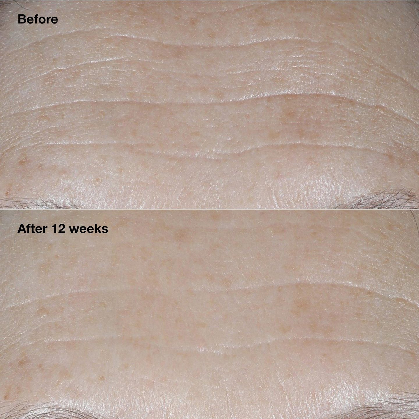 Крем для лица Smart Clinical Repair SPF 30 с коррекцией морщин — фото 3