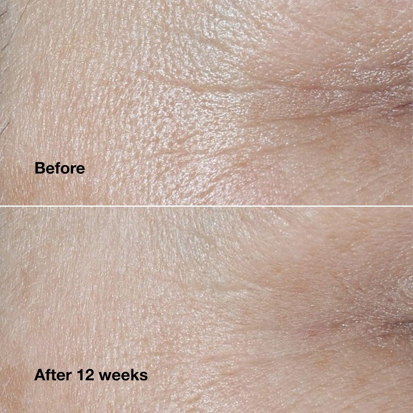 Крем для лица Smart Clinical Repair против морщин — фото 4