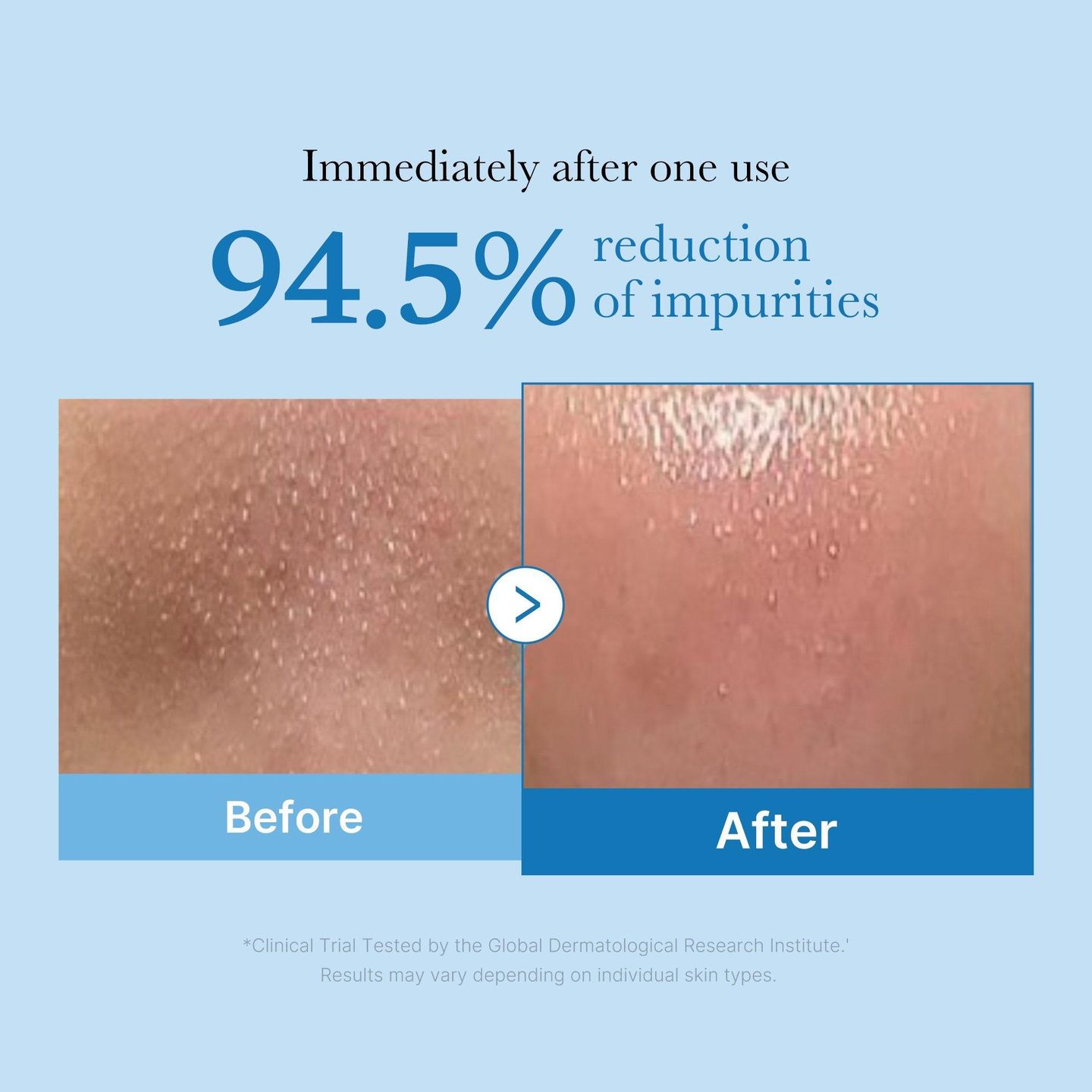 Масло для глубокого очищения пор Zero Pore Blackhead — фото 5