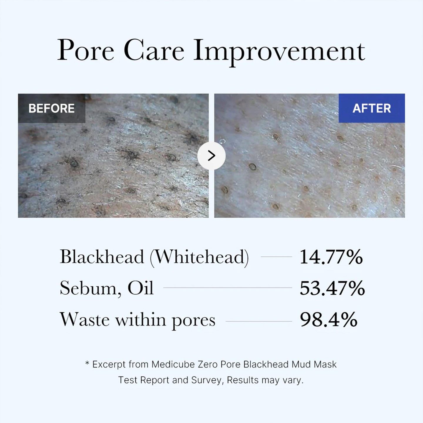 Маска для лица Zero Pore Blackhead Mud Mask — фото 5
