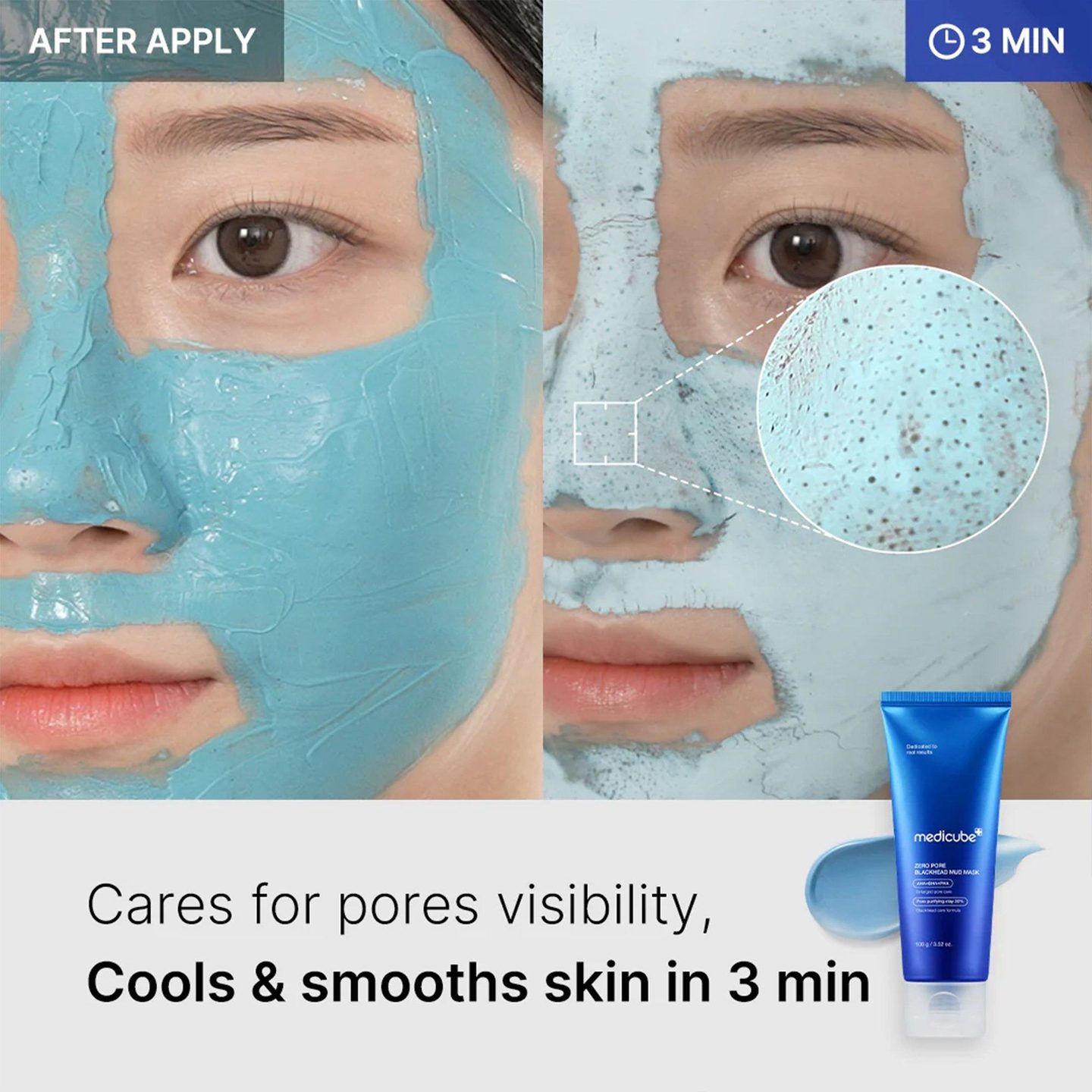 Маска для лица Zero Pore Blackhead Mud Mask — фото 4