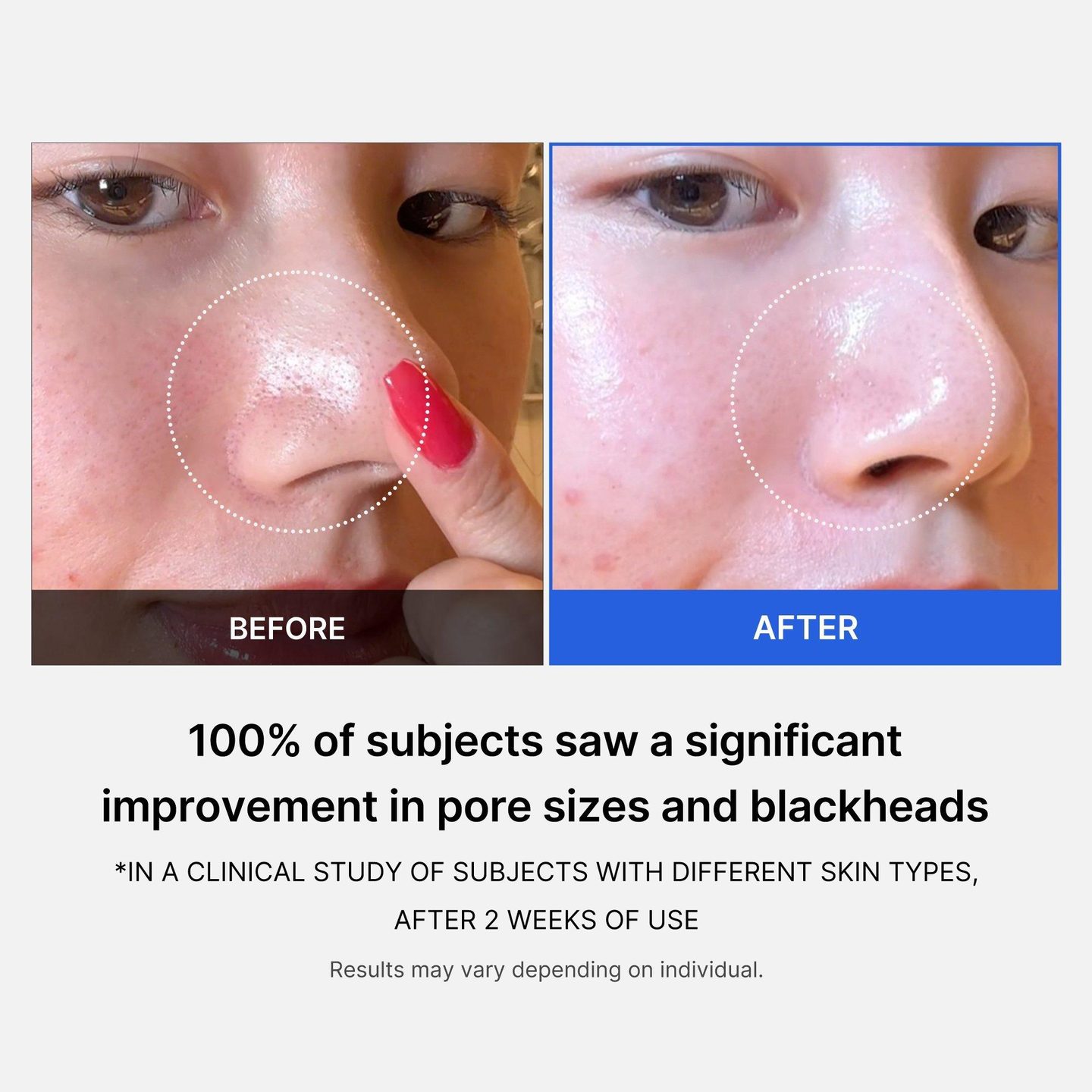 Патчи для сужения пор Zero Pore Pad — фото 6
