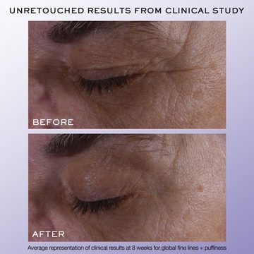 Сыворотка для области вокруг глаз Rénergie H. C. F. Triple Serum — миниатюра 7